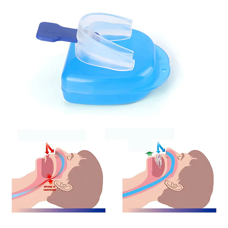 Protector Bucal AntiBruxismo AntiRonquidos Apnea del Sueño