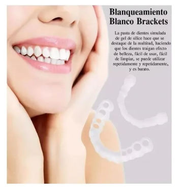 Carillas Dentales Snap On Smile