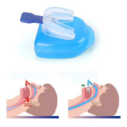 Protector Bucal AntiBruxismo AntiRonquidos Apnea del Sueño
