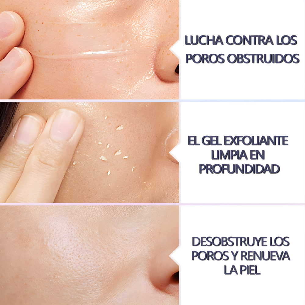 Gel Exfoliante QUARXERY Purificante 50gr